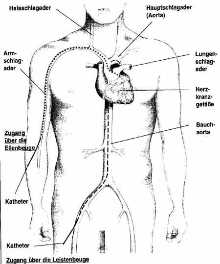 Stent_Eingang_